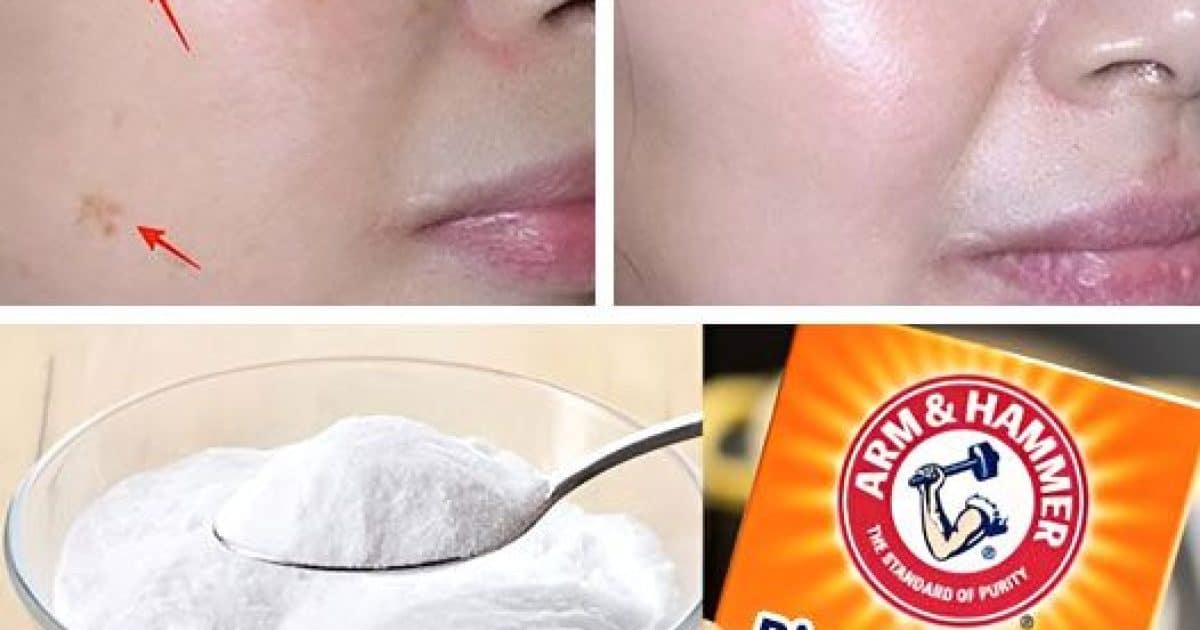 10 astuces à connaitre avec le bicarbonate de soude