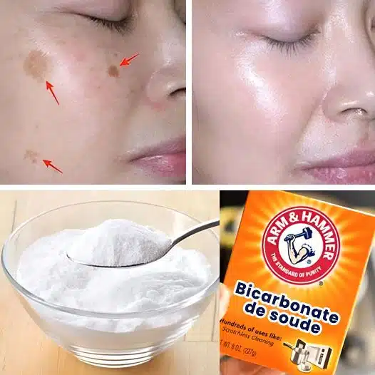 10 astuces à connaitre avec le bicarbonate de soude