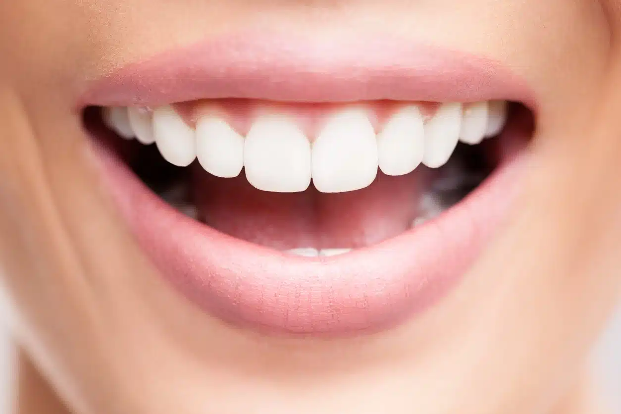 Illustration d'un sourire éclatant
