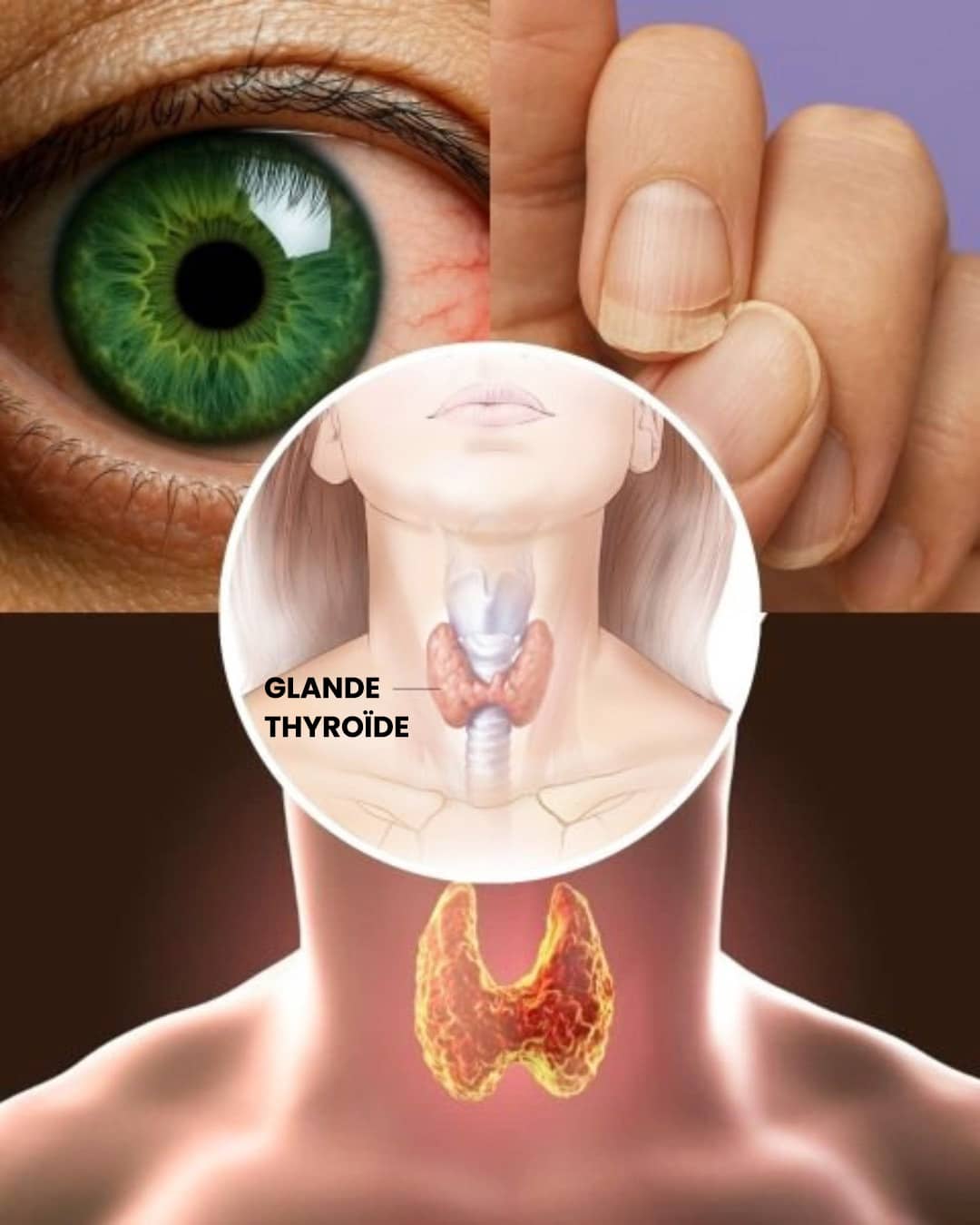 10 signaux cachés indiquant que votre thyroïde ne fonctionne pas correctement