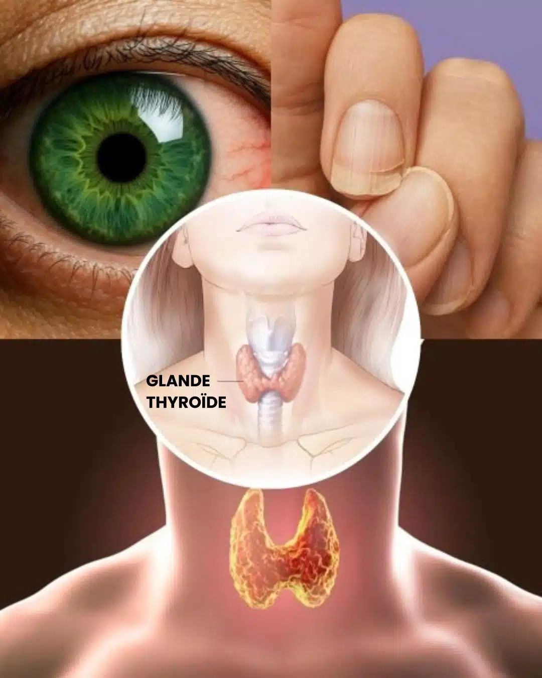 10 signaux cachés indiquant que votre thyroïde ne fonctionne pas correctement