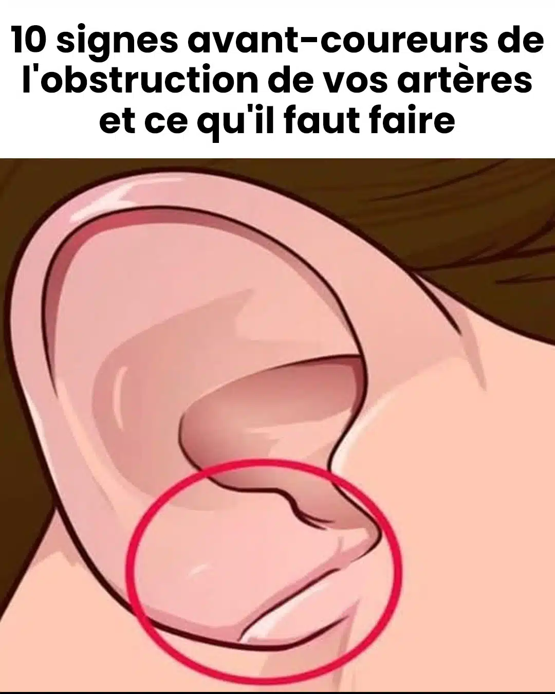 10 signes avant-coureurs indiquant que vos artères sont obstruées et que faire