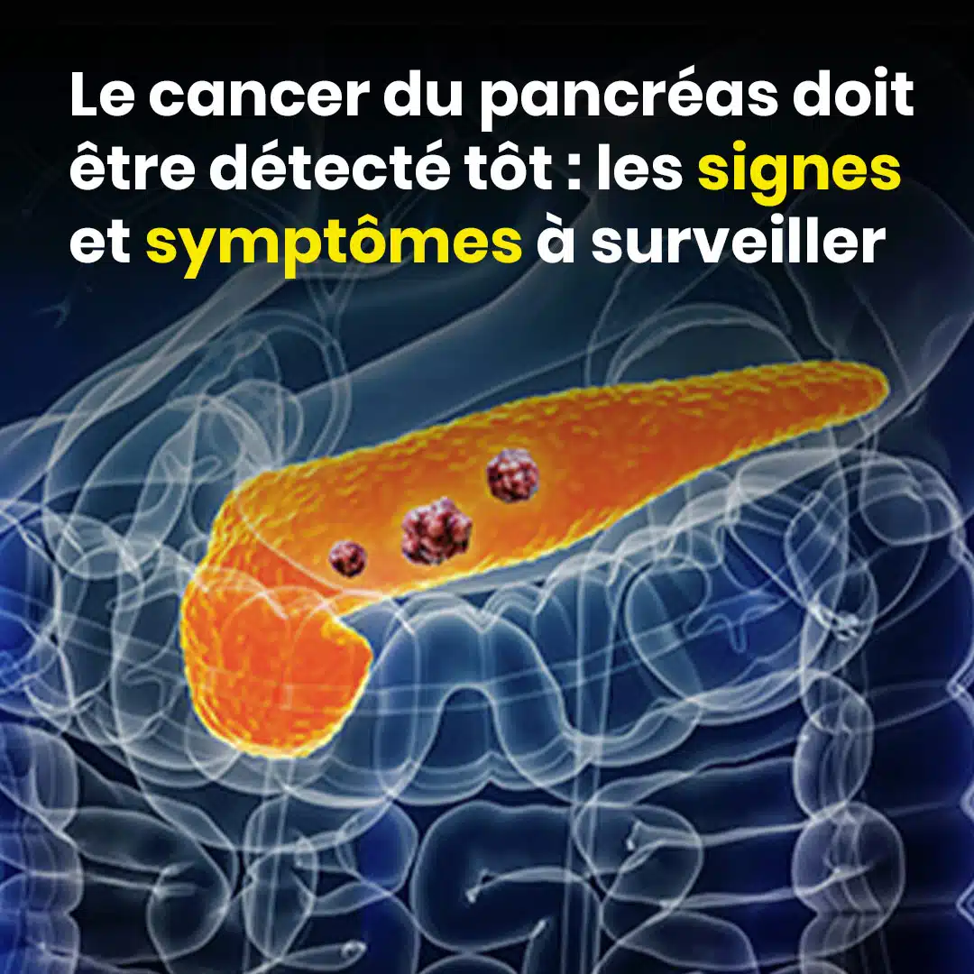 10 signes du cancer du pancréas à ne pas ignorer