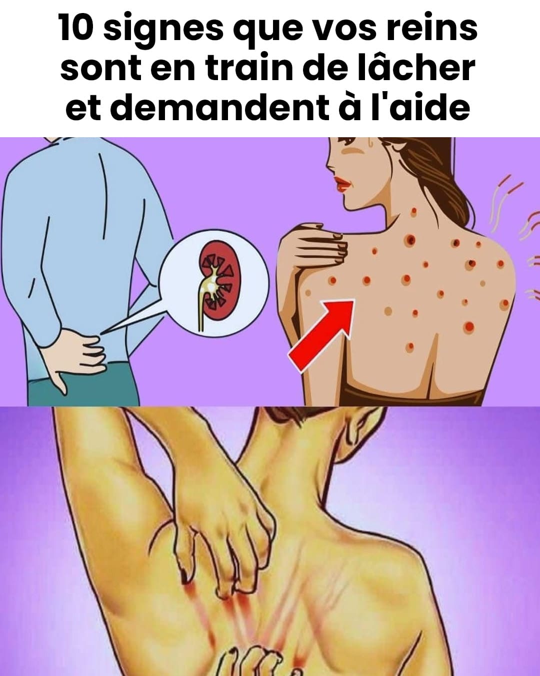 10 signes révélateurs de troubles rénaux