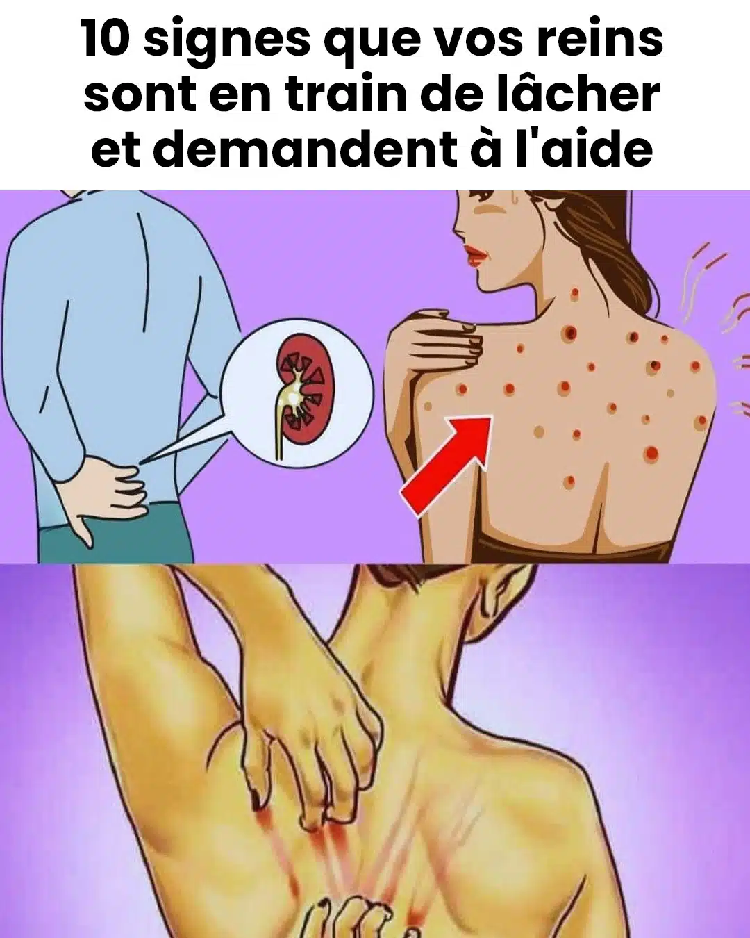 10 signes révélateurs de troubles rénaux