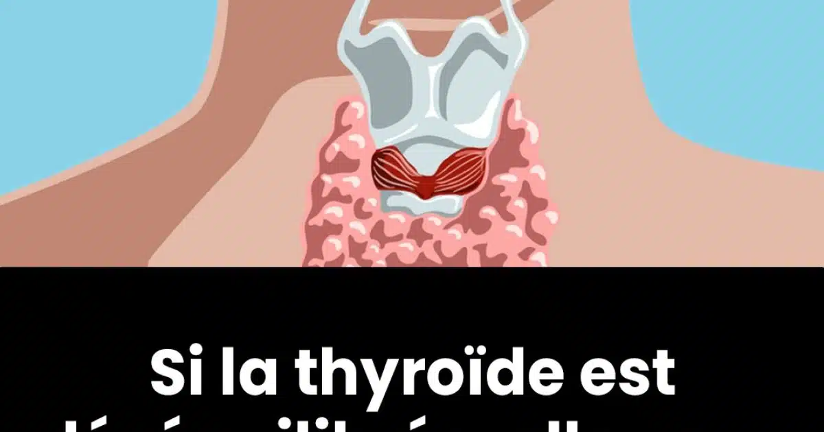 10 symptômes du dysfonctionnement de la thyroïde