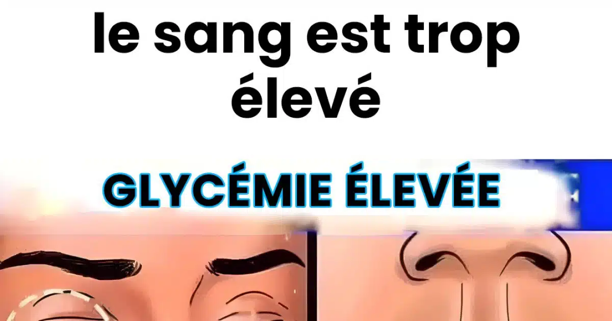 12 signes que votre glycémie est élevée