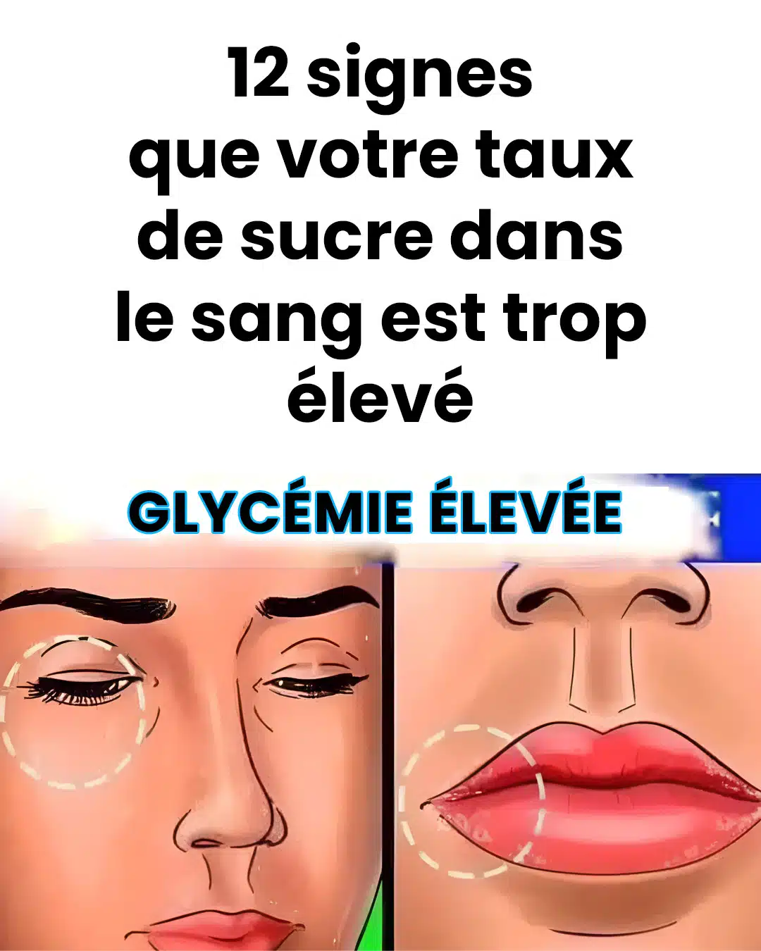 12 signes que votre glycémie est élevée