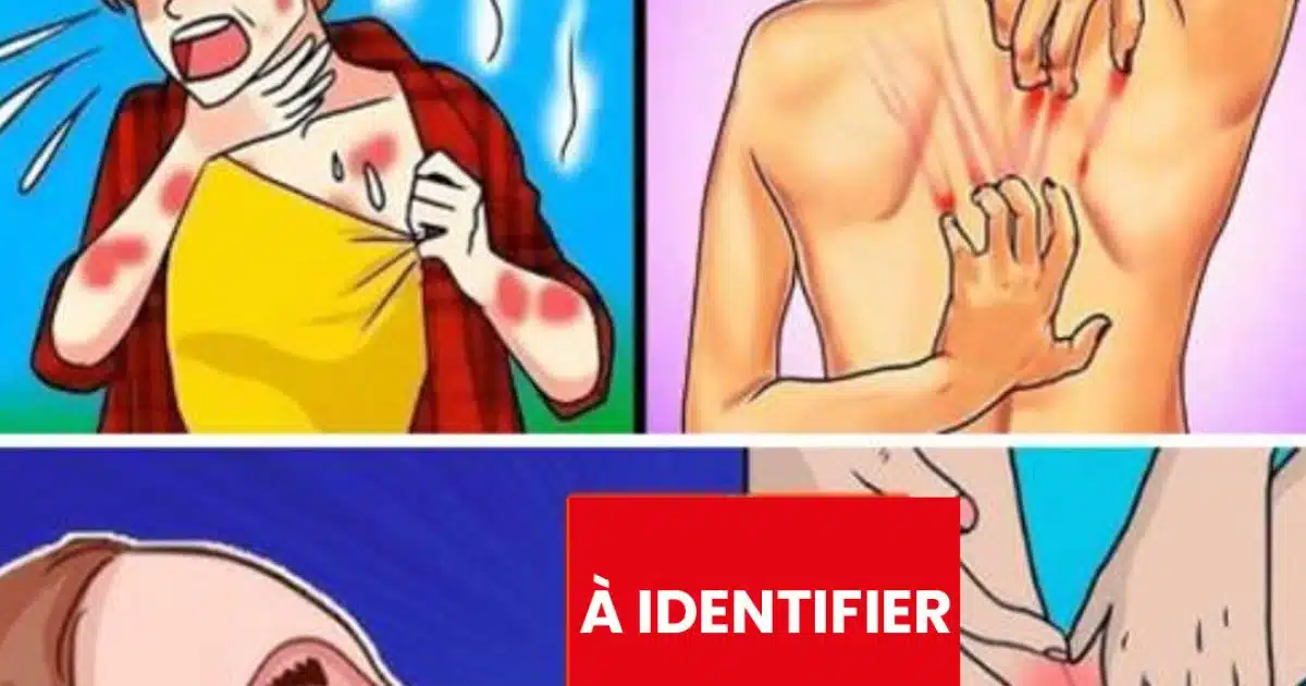 12 symptômes silencieux de l’anémie