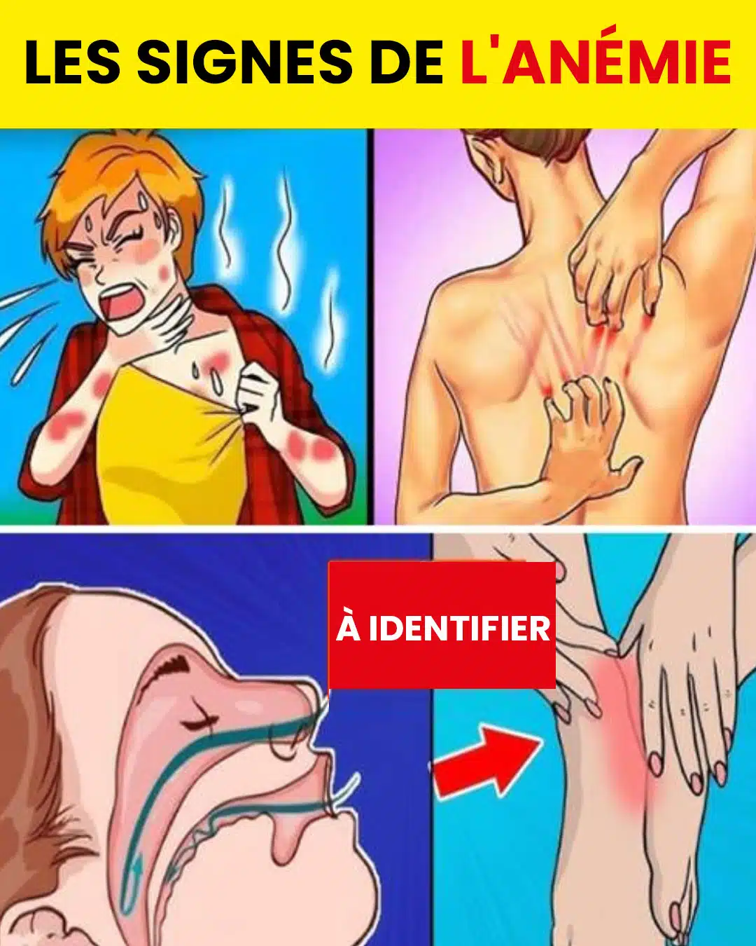 12 symptômes silencieux de l’anémie