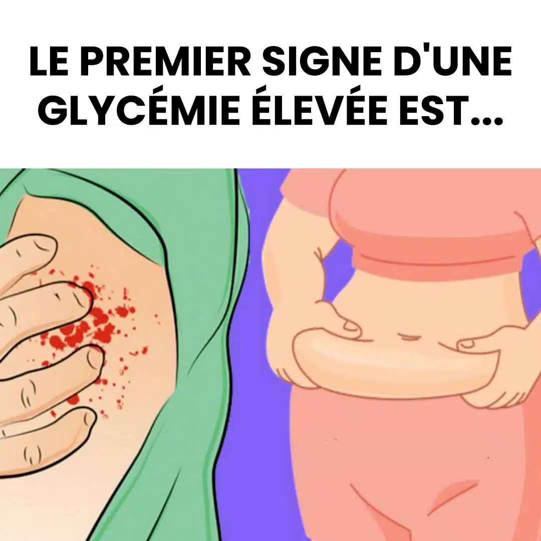13 signes avant-coureurs d'hyperglycémie et 9 façons de prendre le contrôle de votre santé