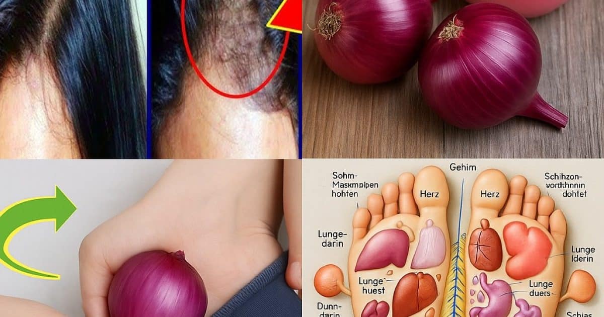 14 façons naturelles dont les oignons peuvent soutenir votre santé