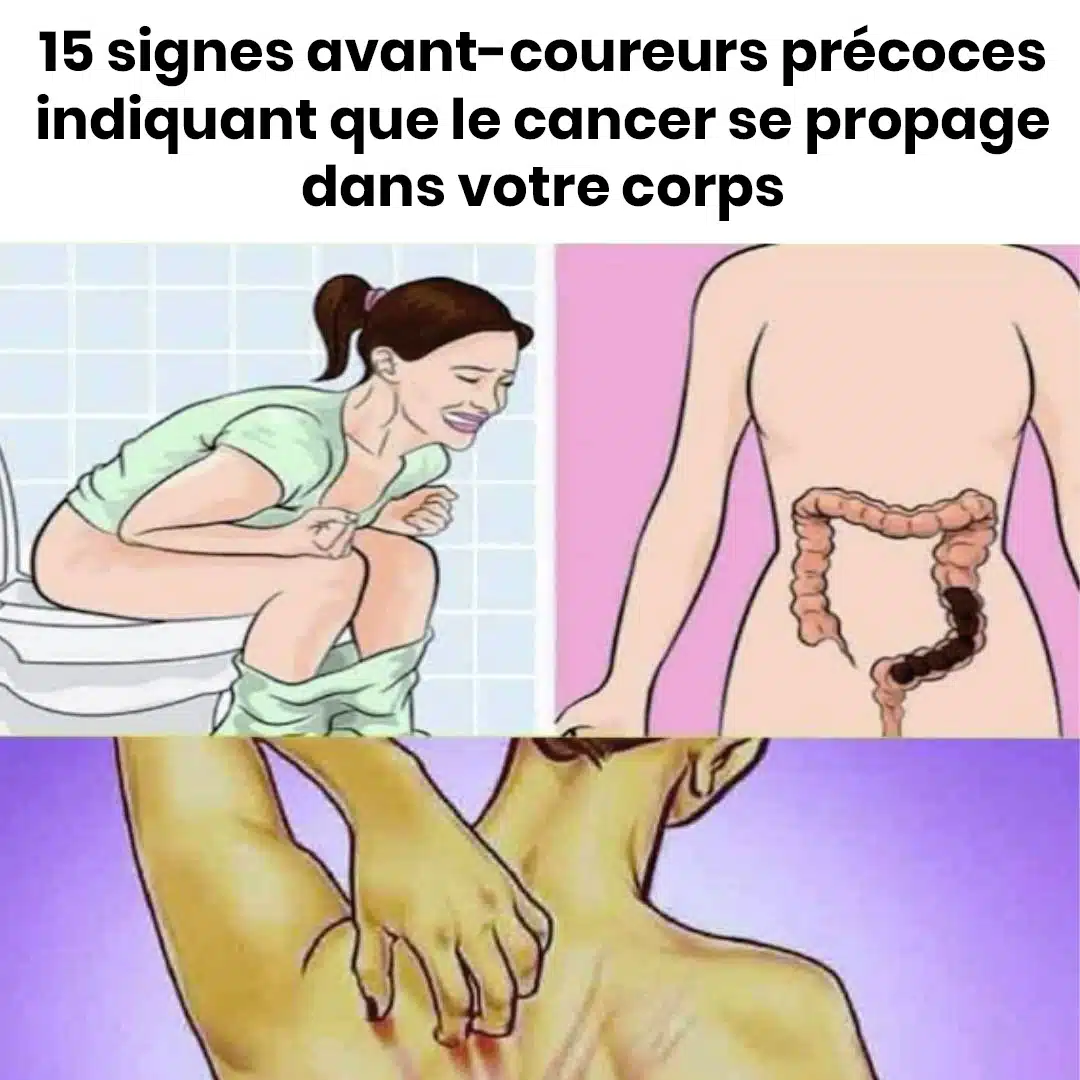 15 symptômes courants du cancer