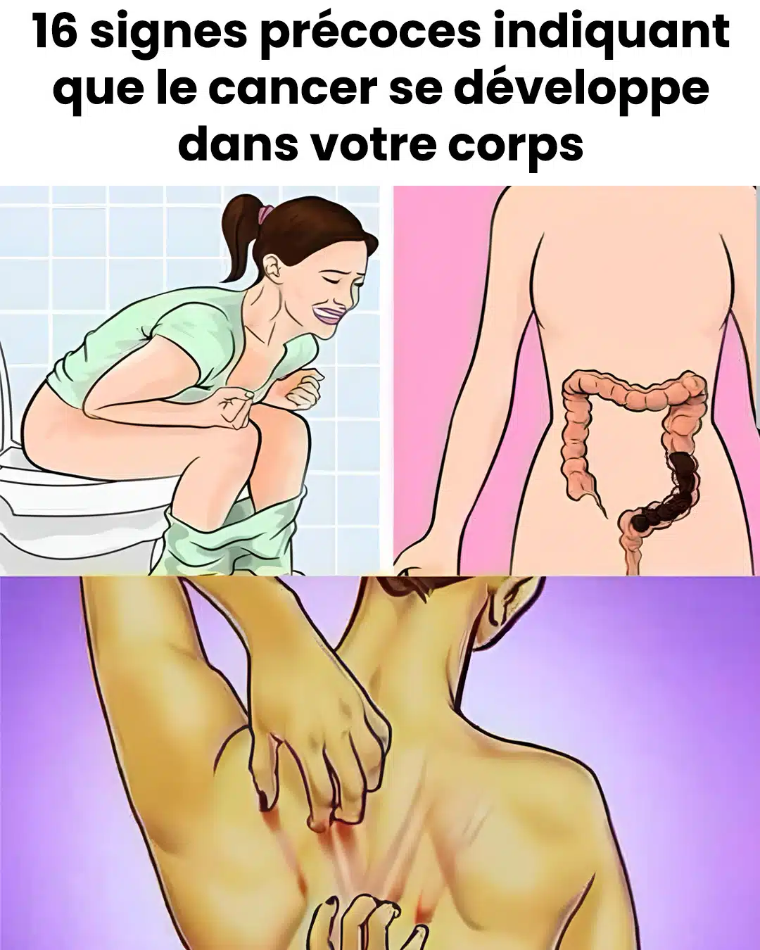 16 signes avant-coureurs du cancer