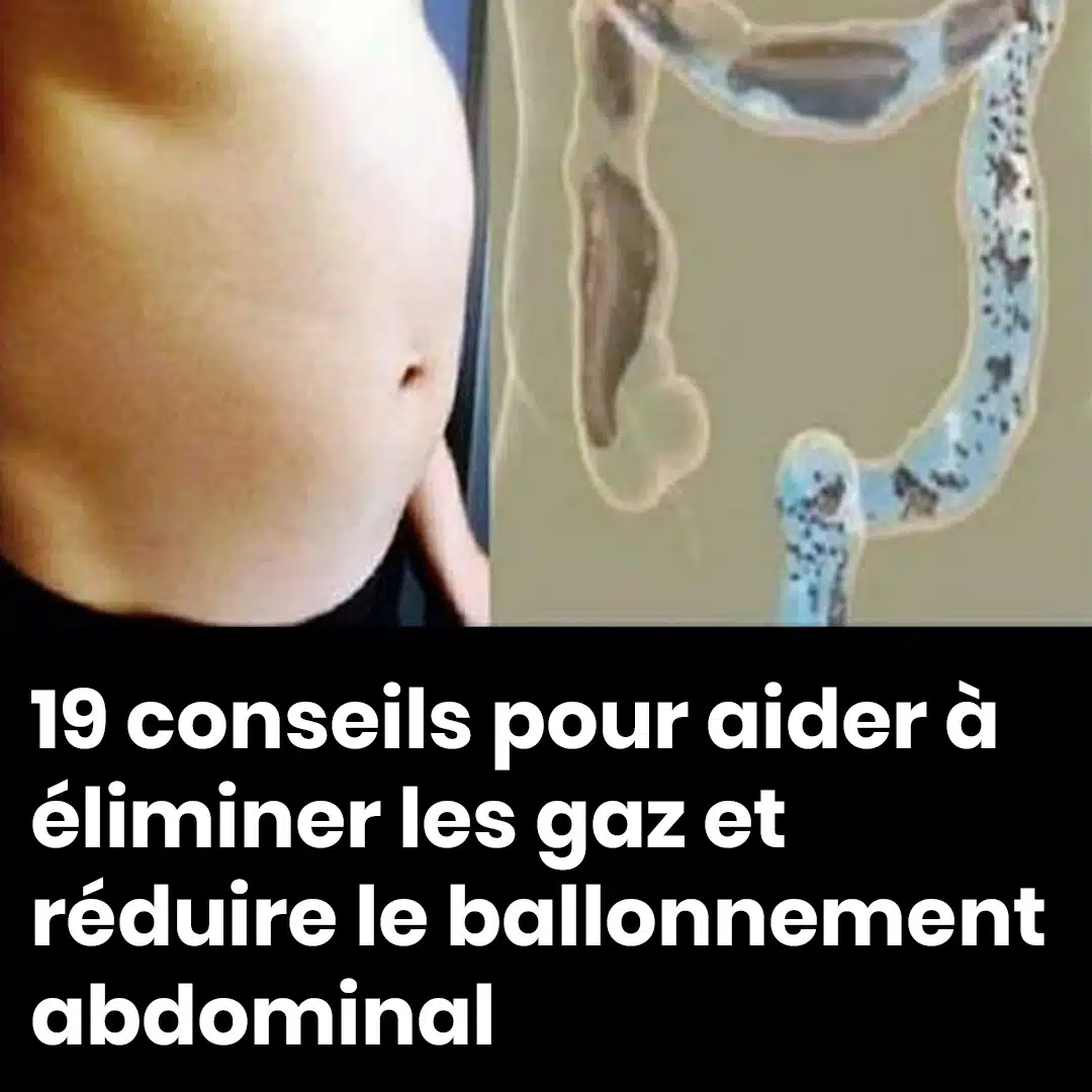 19 conseils pour éliminer les gaz et réduire les ballonnements abdominaux
