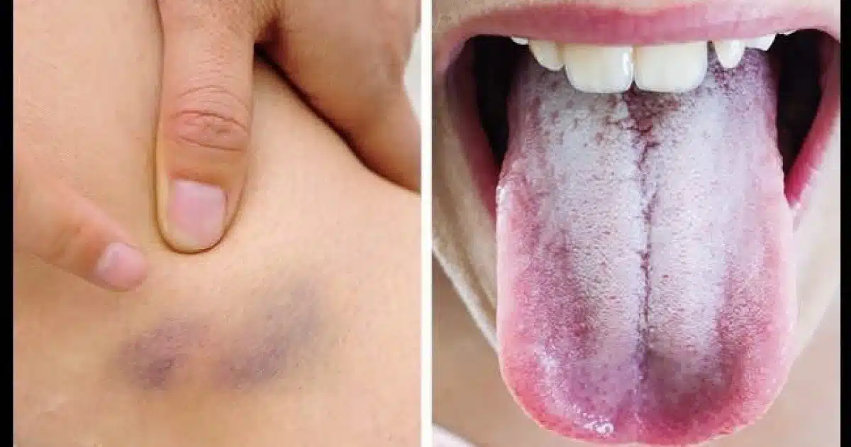 20 signes que votre corps est déséquilibré et que quelque chose ne va pas