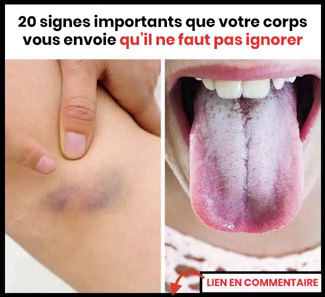 20 signes que votre corps est déséquilibré et que quelque chose ne va pas
