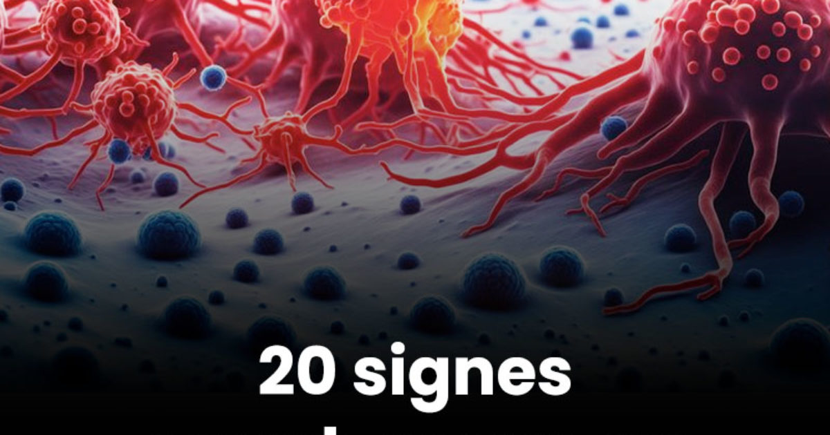 20 symptômes du cancer