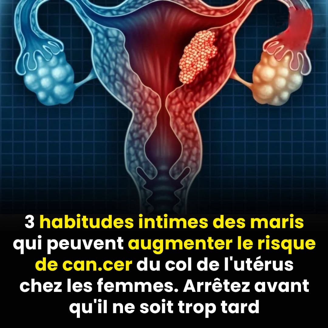 3 habitudes des hommes qui pourraient augmenter le risque de cancer du col de l’utérus chez leurs épouses