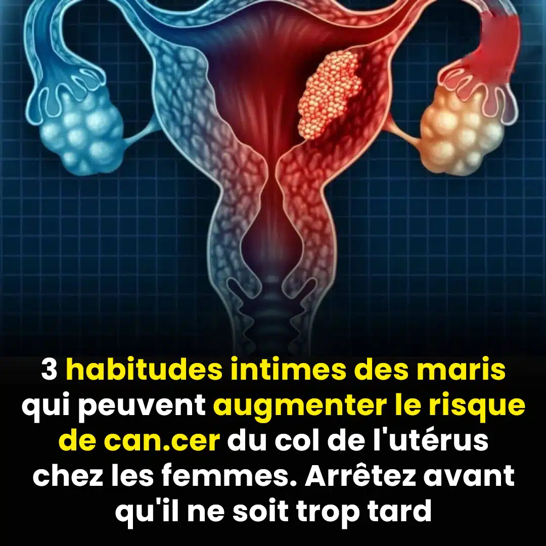 3 habitudes des hommes qui pourraient augmenter le risque de cancer du col de l’utérus chez leurs épouses