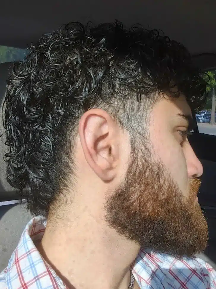 Barbe rousse avec poils corporels noirs