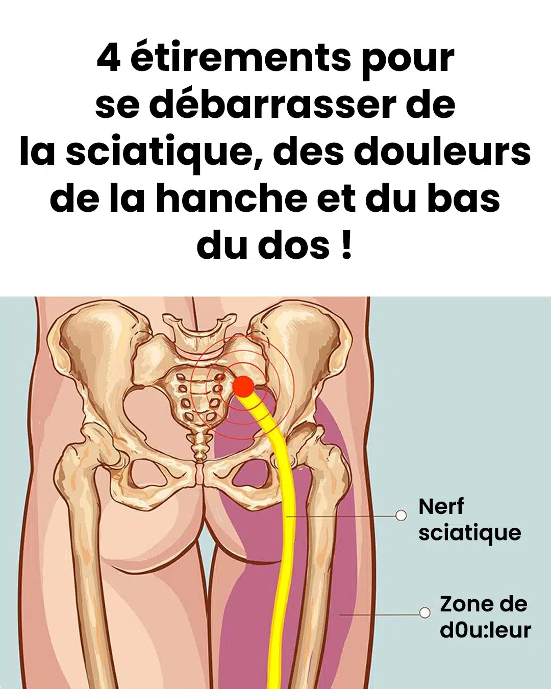 4 exercices pour étirer le piriforme et en finir avec la sciatique et les douleurs du bas du dos
