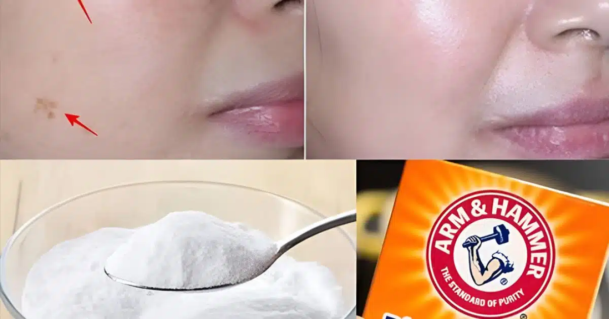 4 façons d'effacer les taches de vieillesse avec du bicarbonate de soude pour une peau jeune et uniforme