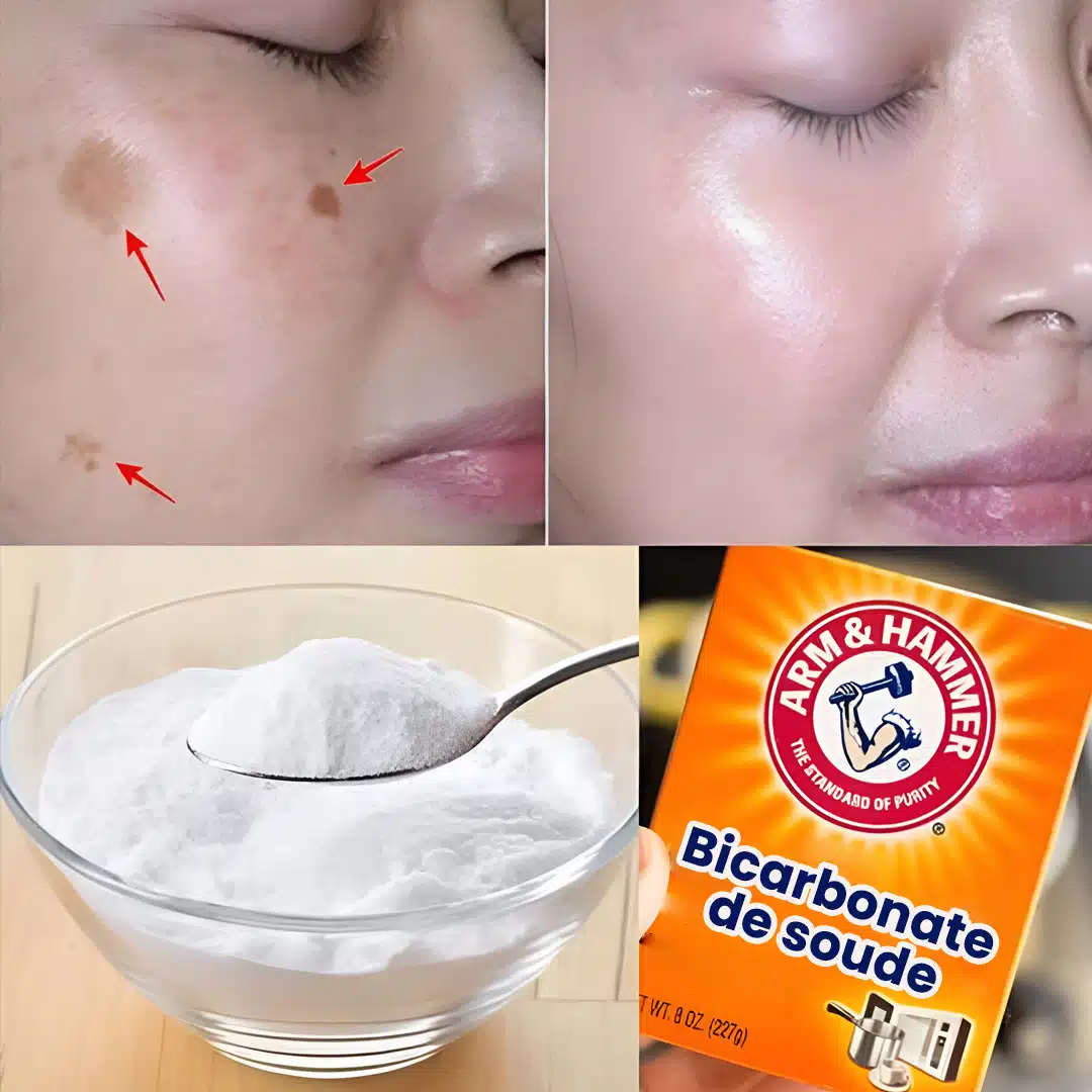 4 façons d'effacer les taches de vieillesse avec du bicarbonate de soude pour une peau jeune et uniforme