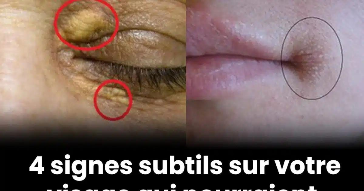 4 signes subtils sur votre visage qui pourraient révéler des problèmes de santé