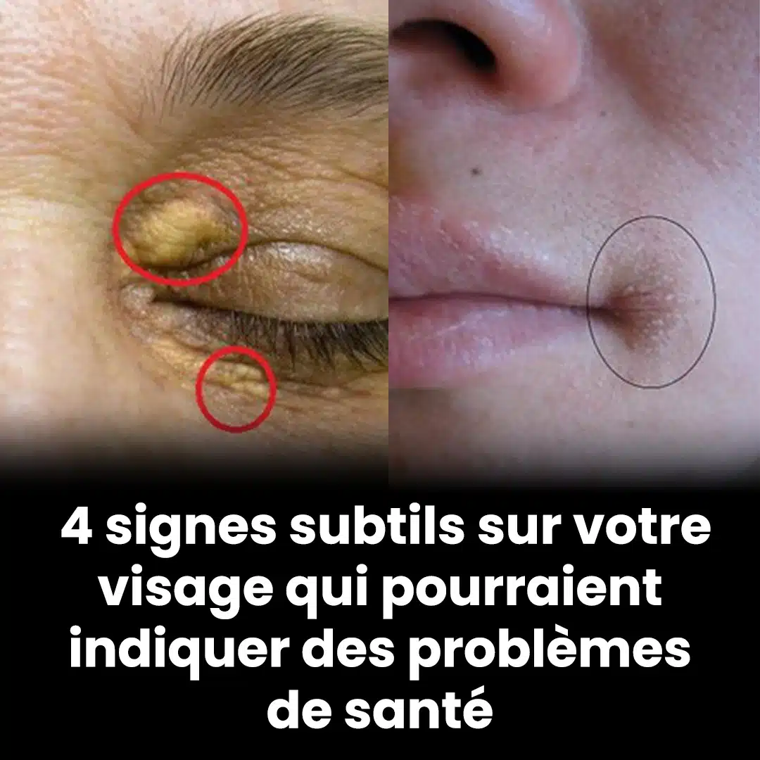 4 signes subtils sur votre visage qui pourraient révéler des problèmes de santé