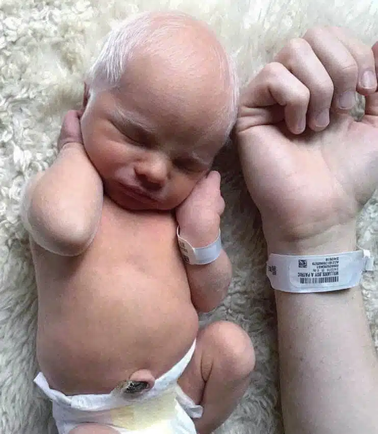 Redd, enfant albinos souriant avec ses cheveux blancs