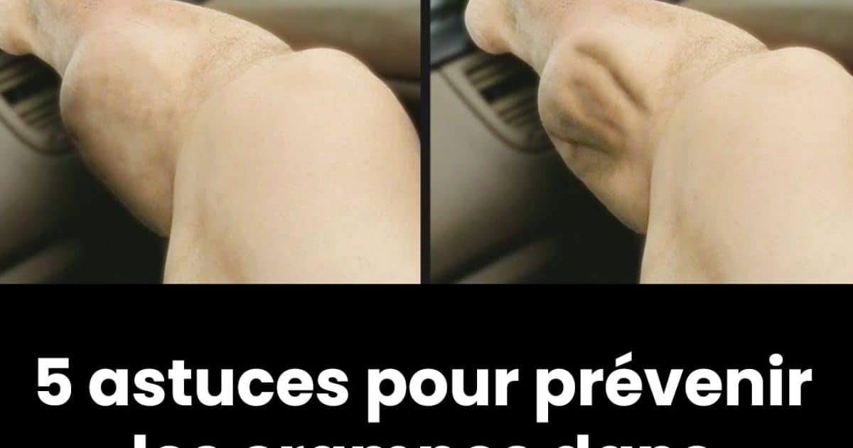 5 conseils pour prévenir les crampes dans les jambes