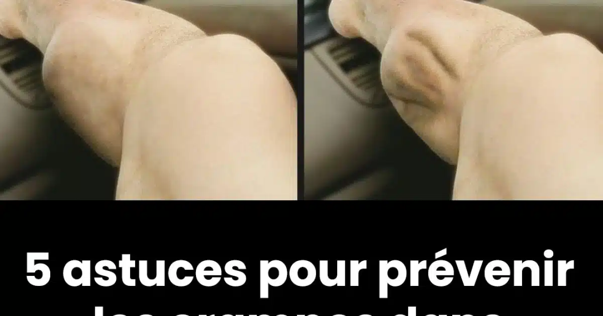 5 conseils pour prévenir les crampes dans les jambes