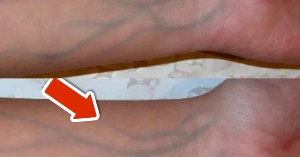 5 signes de mauvaise circulation que vous ne devriez JAMAIS ignorer