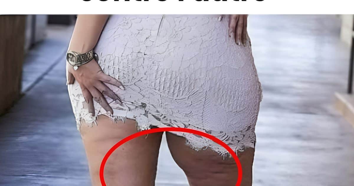 6 astuces pour soulager les cuisses qui frottent l'une contre l'autre