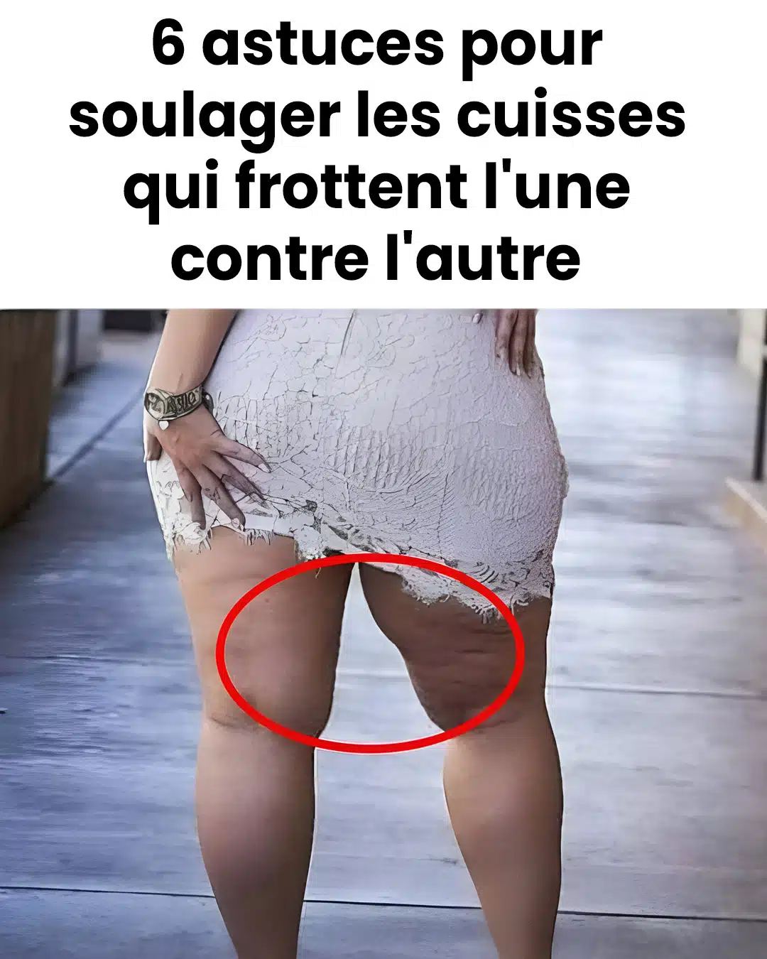 6 astuces pour soulager les cuisses qui frottent l'une contre l'autre
