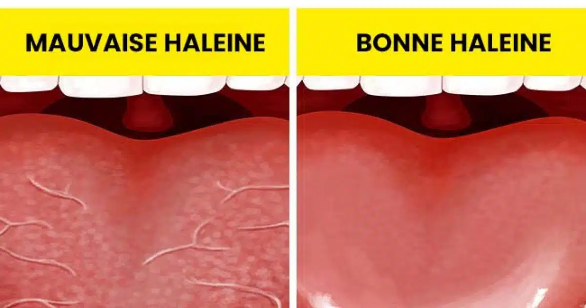6 façons d’éviter la mauvaise haleine même au réveil