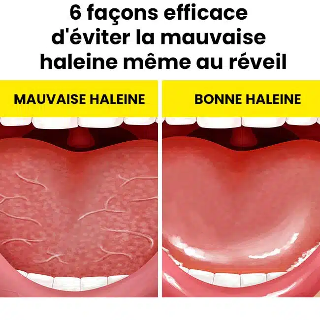 6 façons d’éviter la mauvaise haleine même au réveil