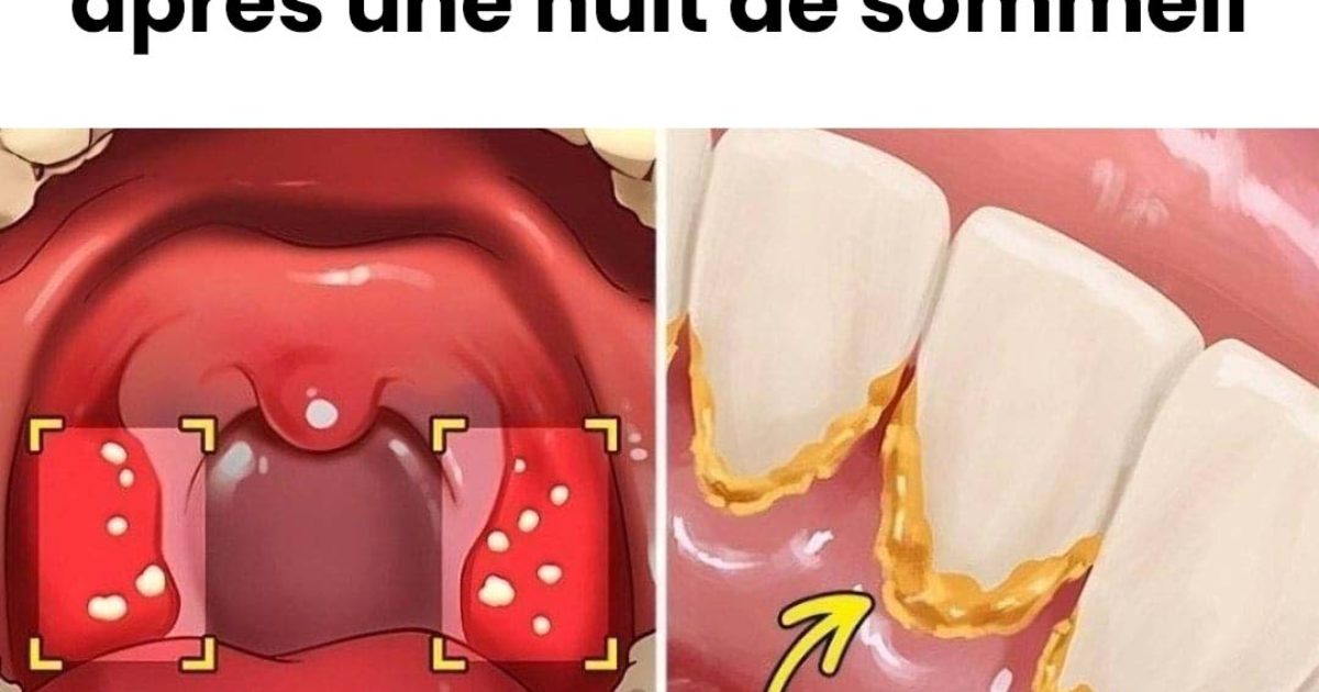 6 méthodes pour éviter la mauvaise haleine