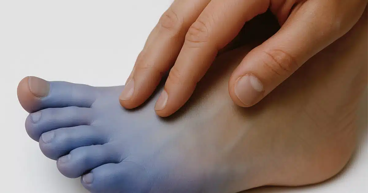 6 raisons pour lesquelles vos pieds sont froids