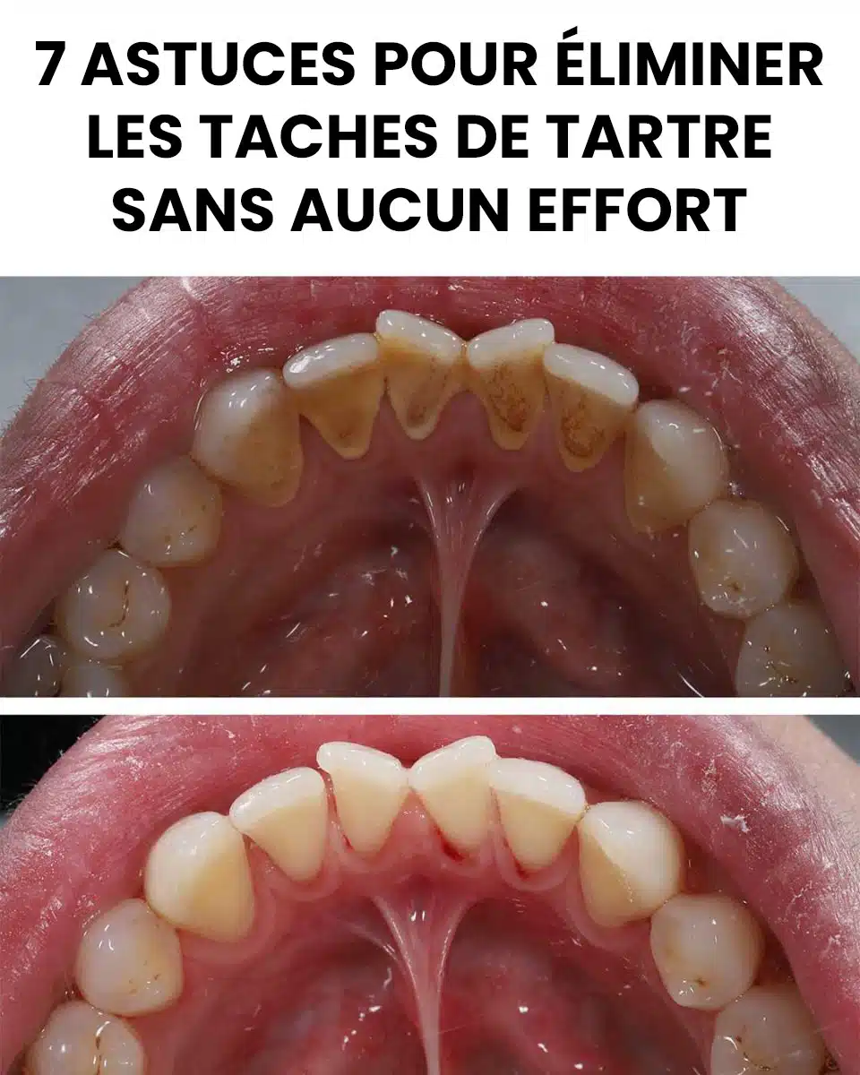 7 astuces géniales pour éliminer les taches de tartre