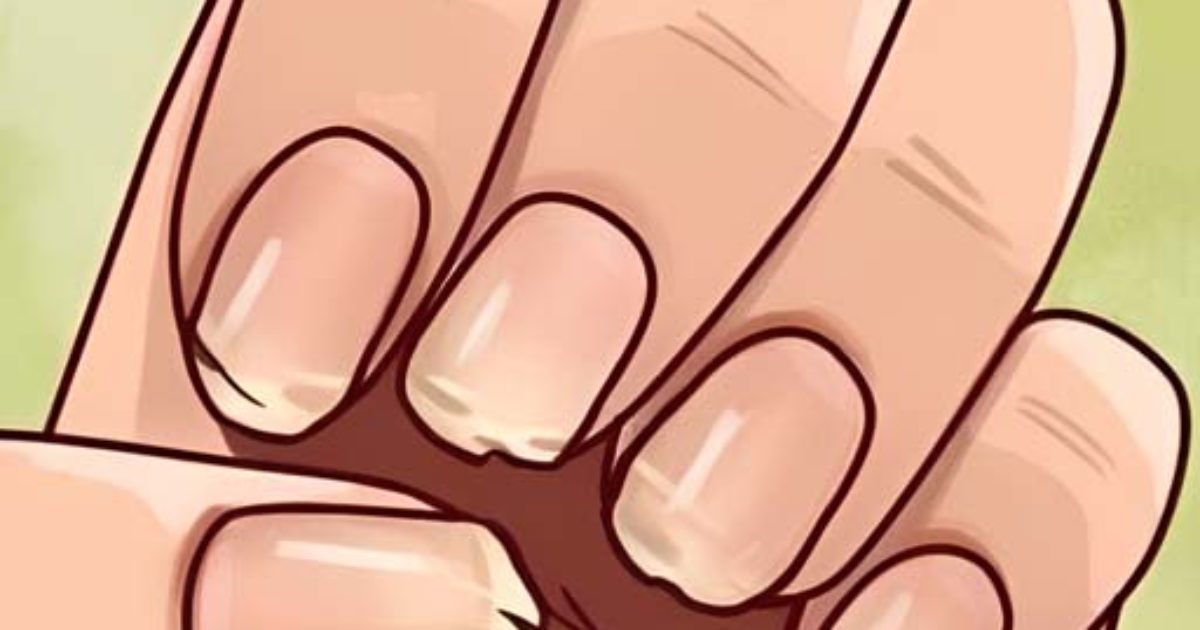 7 problèmes de santé cachés dans vos ongles