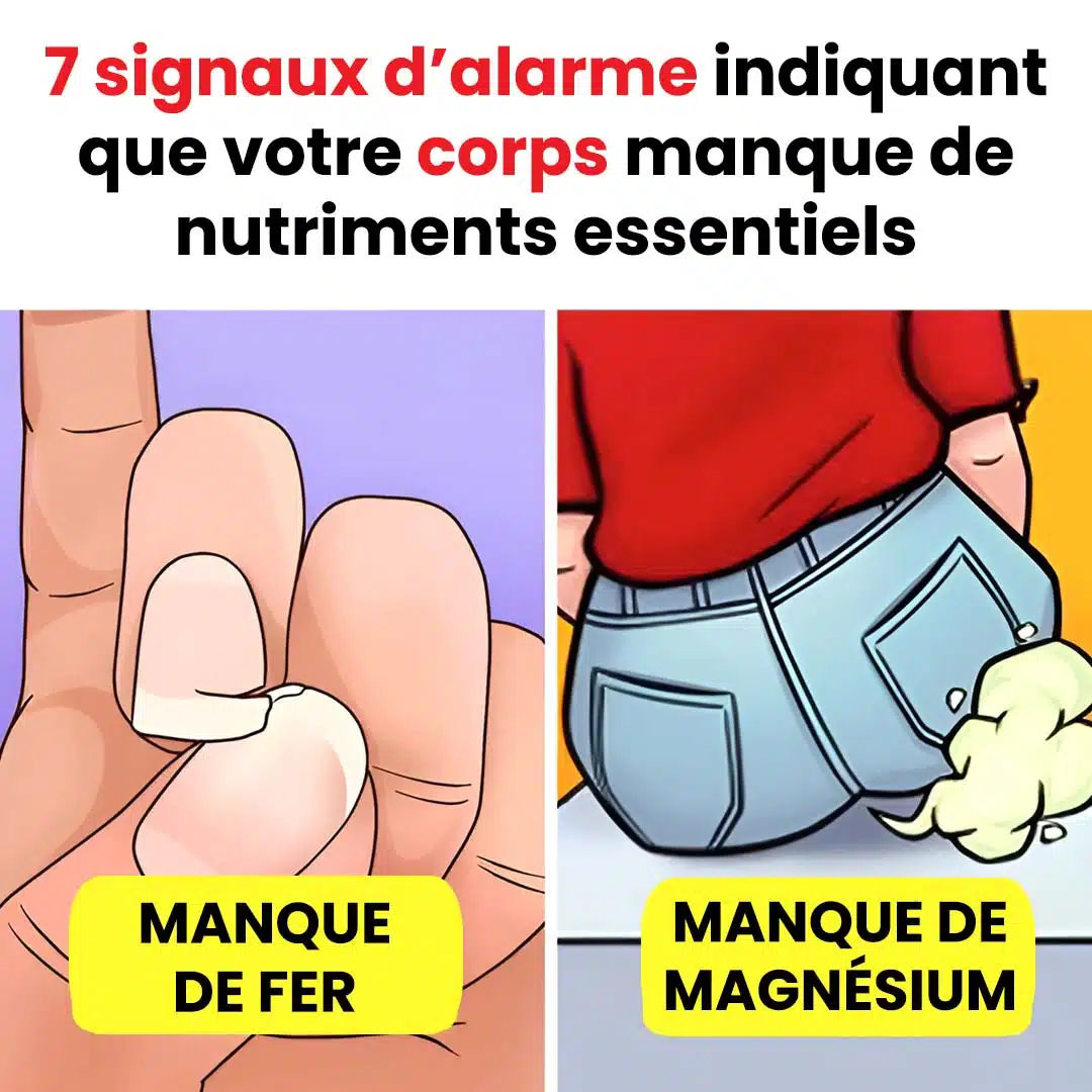 7 signaux indiquant que votre corps manque de nutriments essentiels