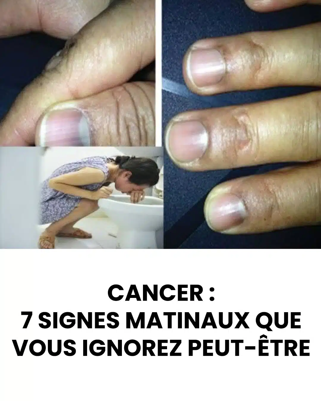 7 signes discrets de cancer qui peuvent apparaître dès le matin