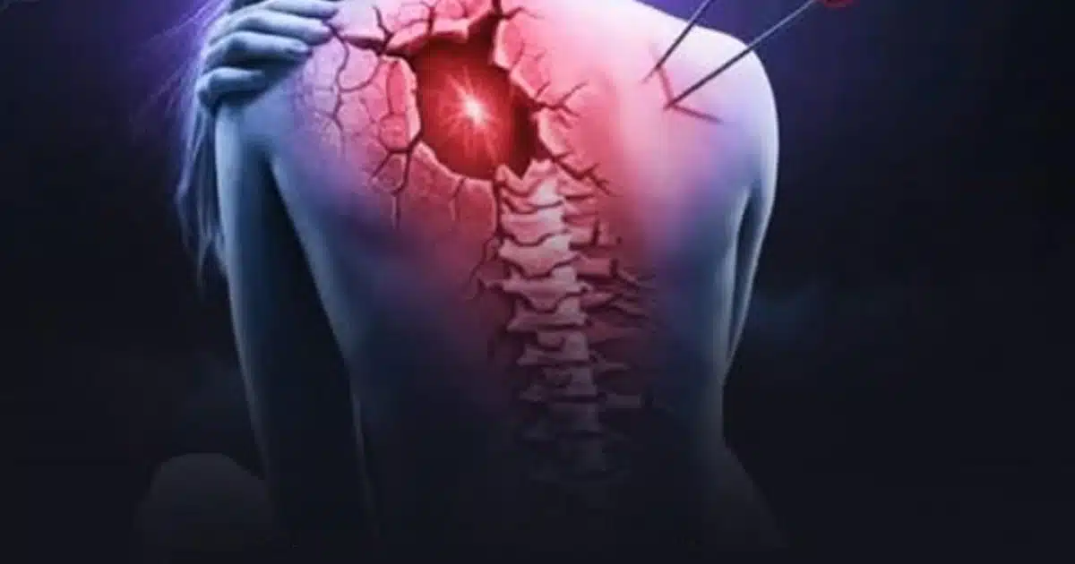 7 symptômes de la Fibromyalgie