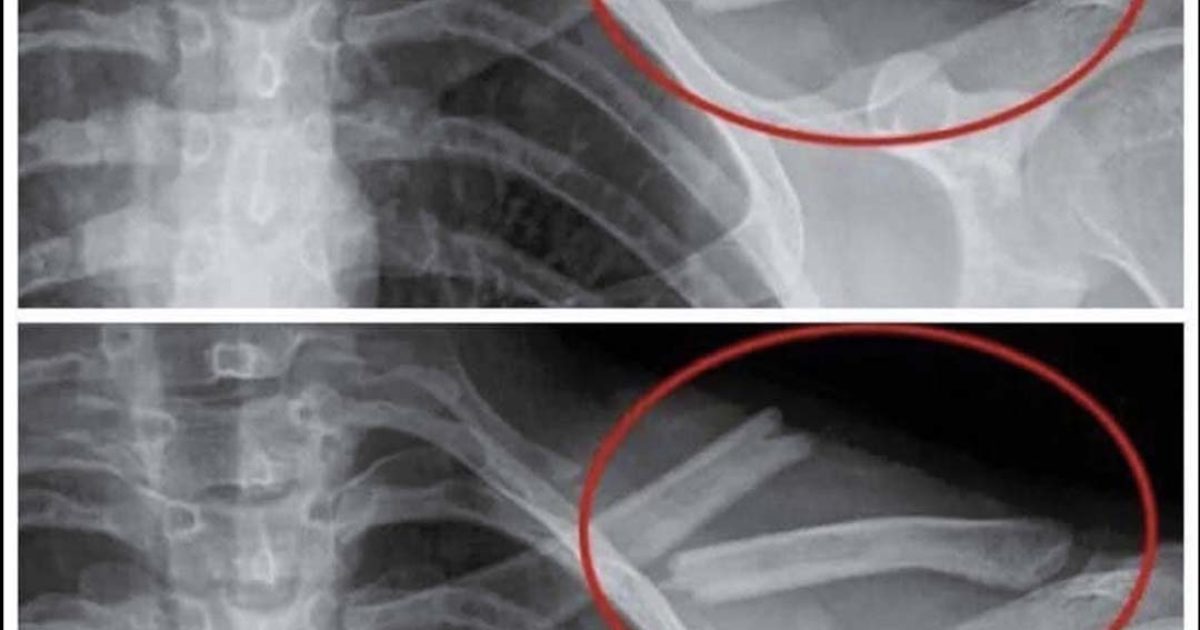 8 choses qui arrivent à votre corps lorsque vous arrêtez de boire du soda light