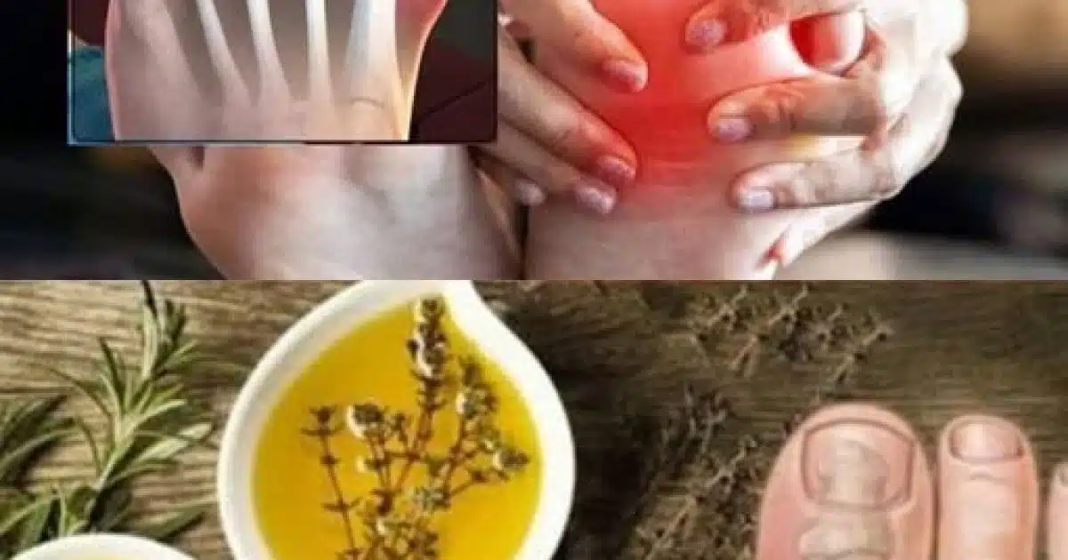 8 façons simples de réduire naturellement l'excès d'acide urique