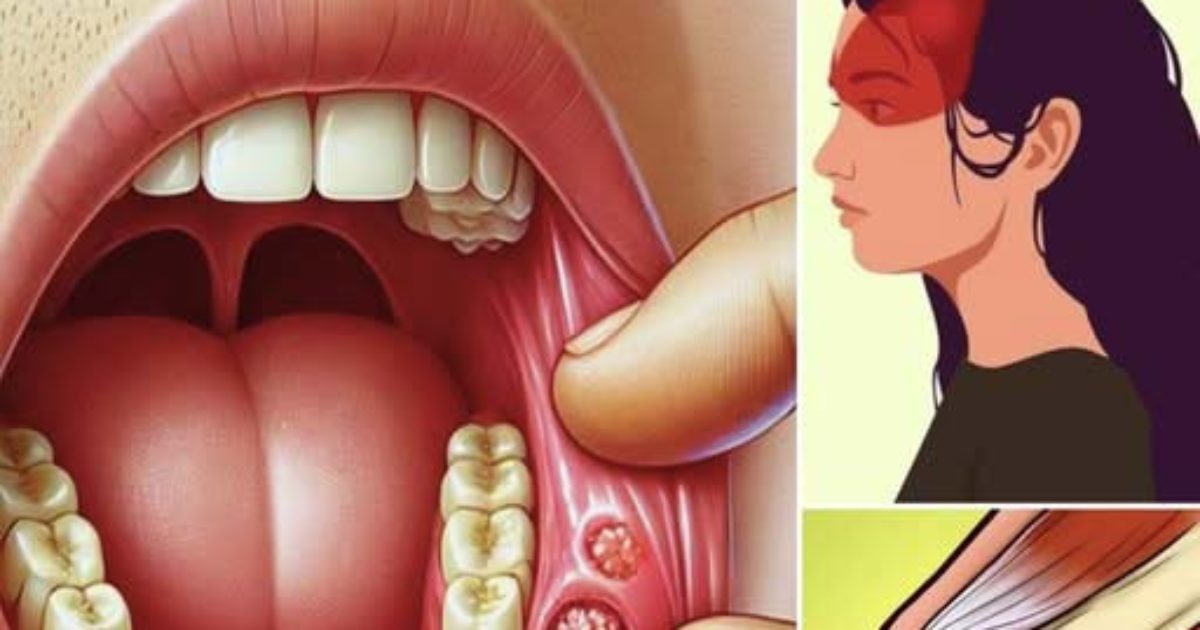 8 signes que votre corps pourrait vous indiquer que vous êtes intolérant au lactose