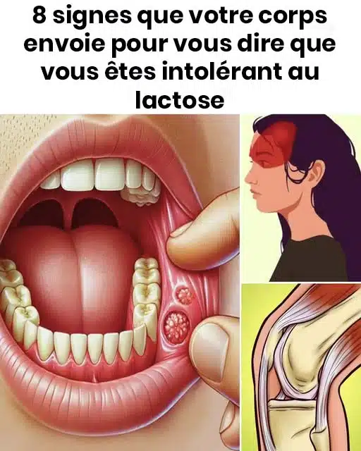 8 signes que votre corps pourrait vous indiquer que vous êtes intolérant au lactose