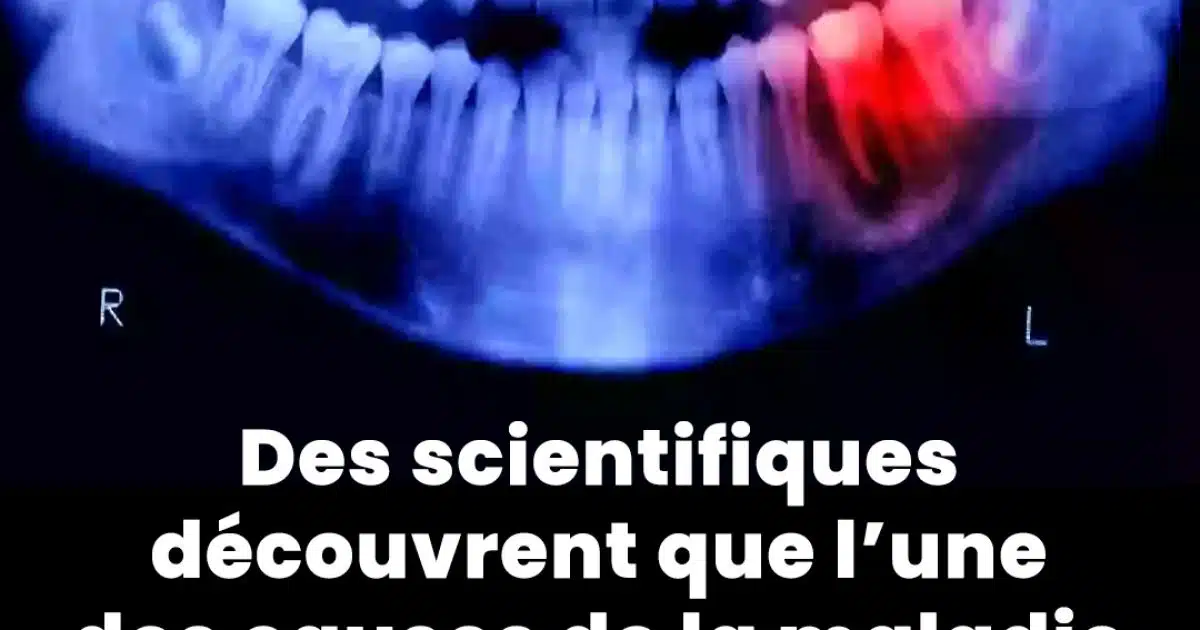 Des scientifiques découvrent que l’une des causes de la maladie d'Alzheimer pourrait en fait provenir de l'intérieur de votre bouche